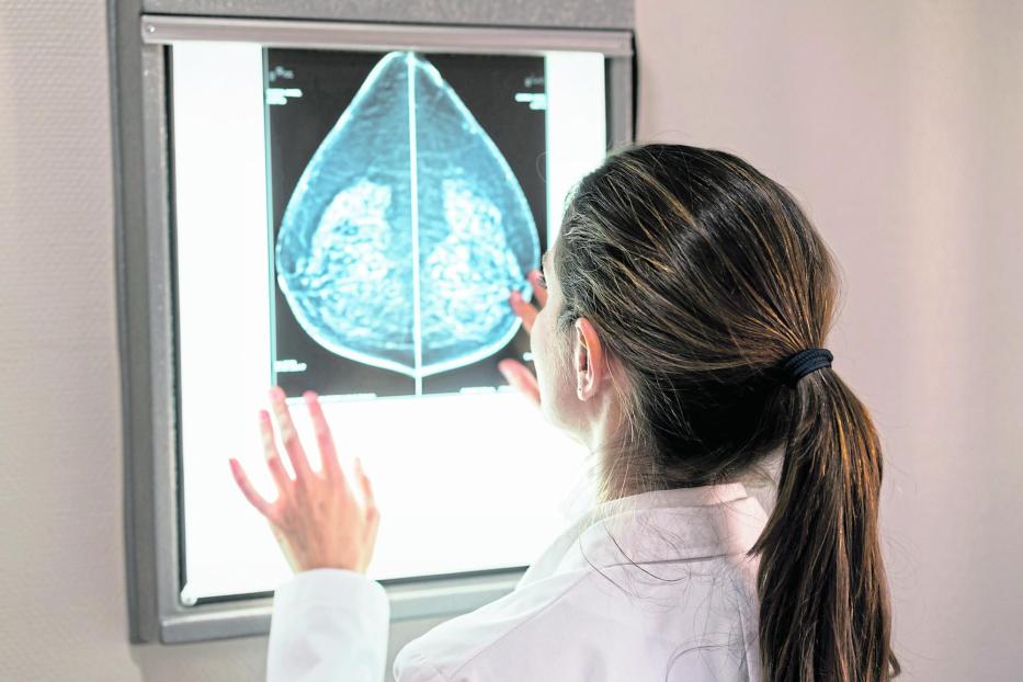 Unrecognizable female gynocologist looking at a mammogram at the hospital