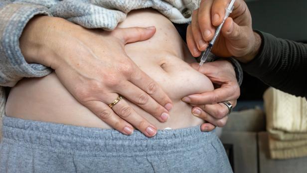GLP-1 - Weight Loss Drug