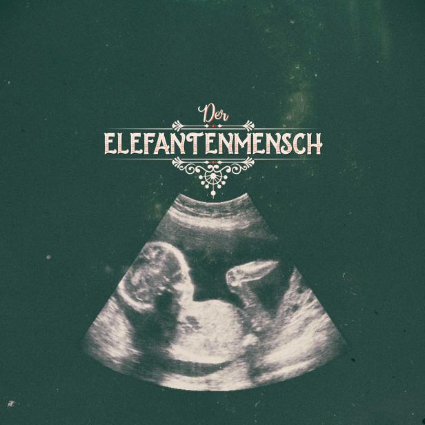der-elefantenmensch-web-0.jpg