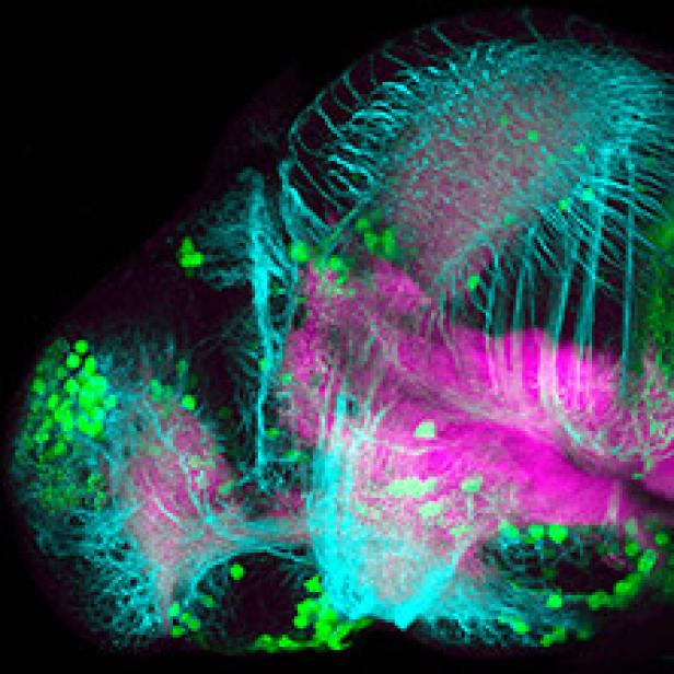 Eine mikroskopische Aufnahme eines Gehirns, hervorgehoben in Türkis, Pink und Grün.
